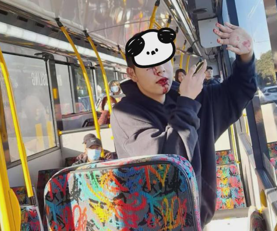 一名16歲中國留學生在新西蘭奧克蘭的巴士上，遭人用金屬棍襲擊，面部嚴重損傷。(網上圖片)