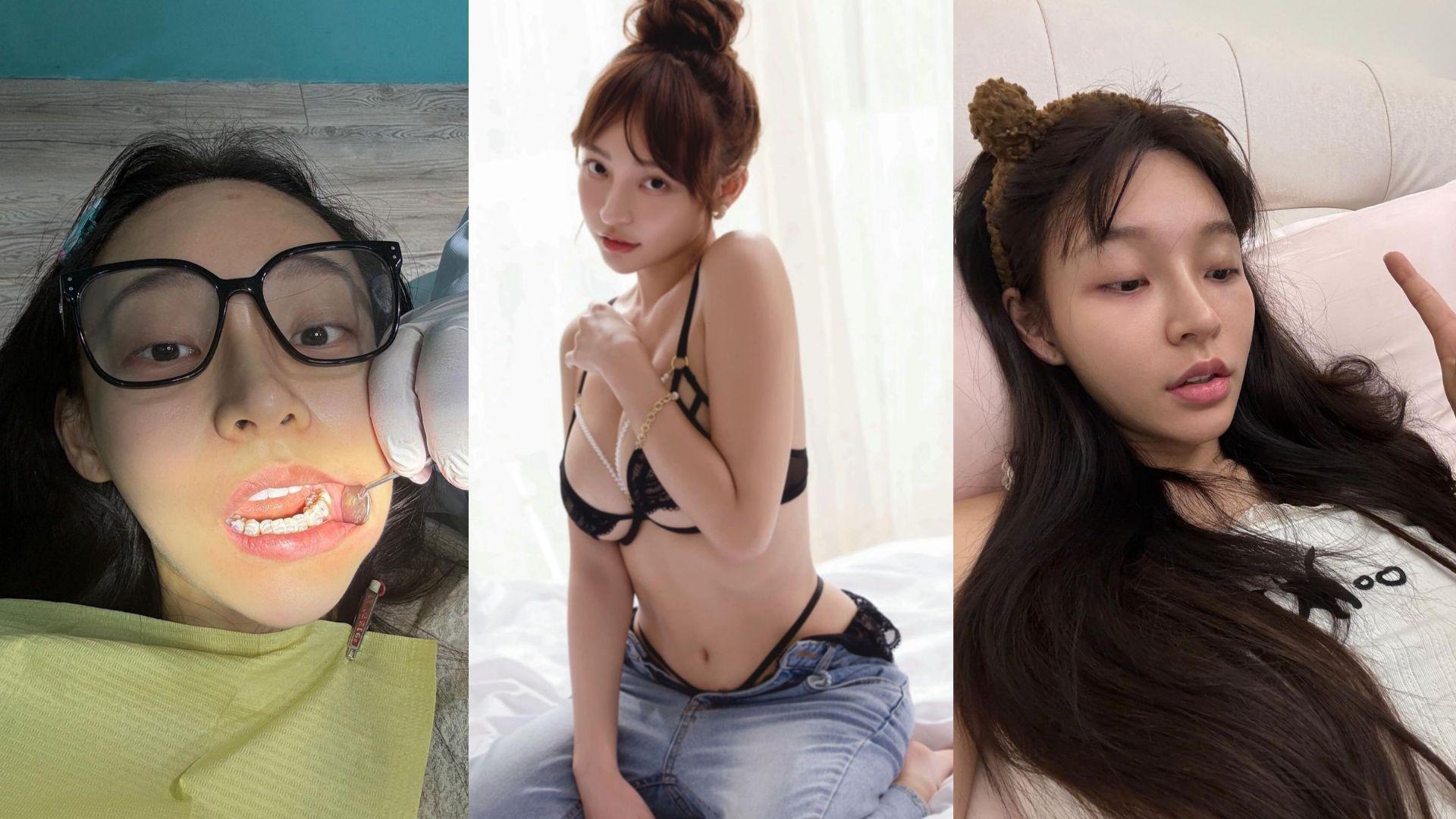 林襄慣性忍尿致膀胱炎發作 公開憔悴素顏嚇壞粉絲