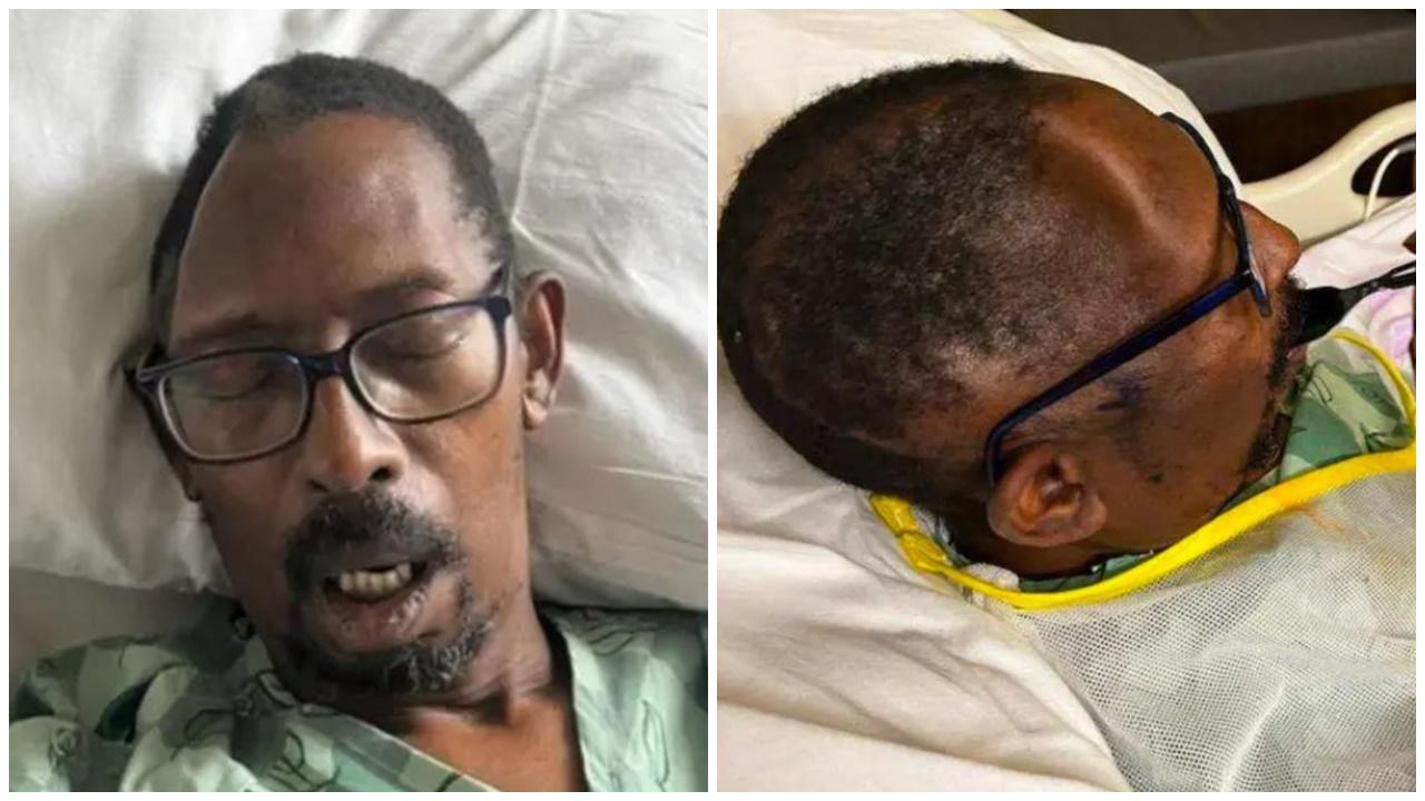 開腦手術醫院遺失頭骨，美漢頭部凹陷還要自費修補。(X)