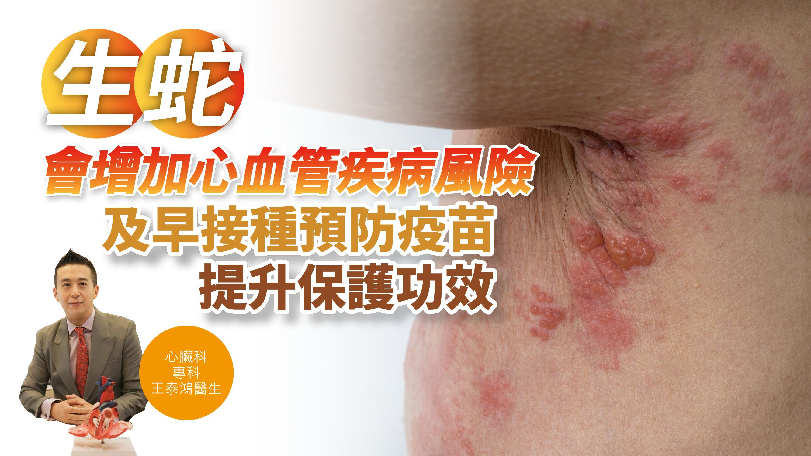 健康解碼｜「生蛇」會增加心血管疾病風險 及早接種預防疫苗 提升保護功效