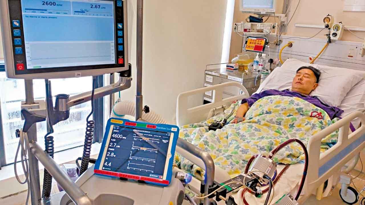 心臟功能僅餘兩成急須換心  五旬漢僅盼行得返出嚟已好開心