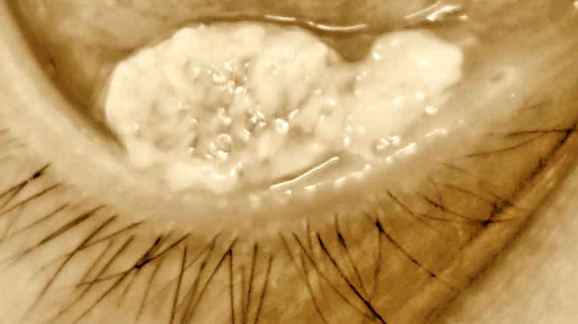 別碰我的眼睛！ 