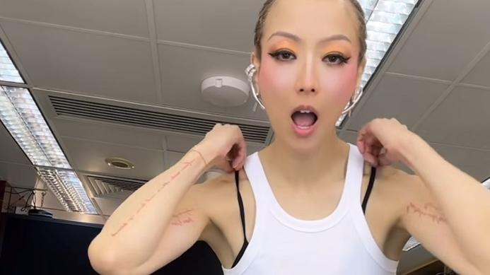 鄭秀文完騷繼續唱 東京狂食身體叫救命