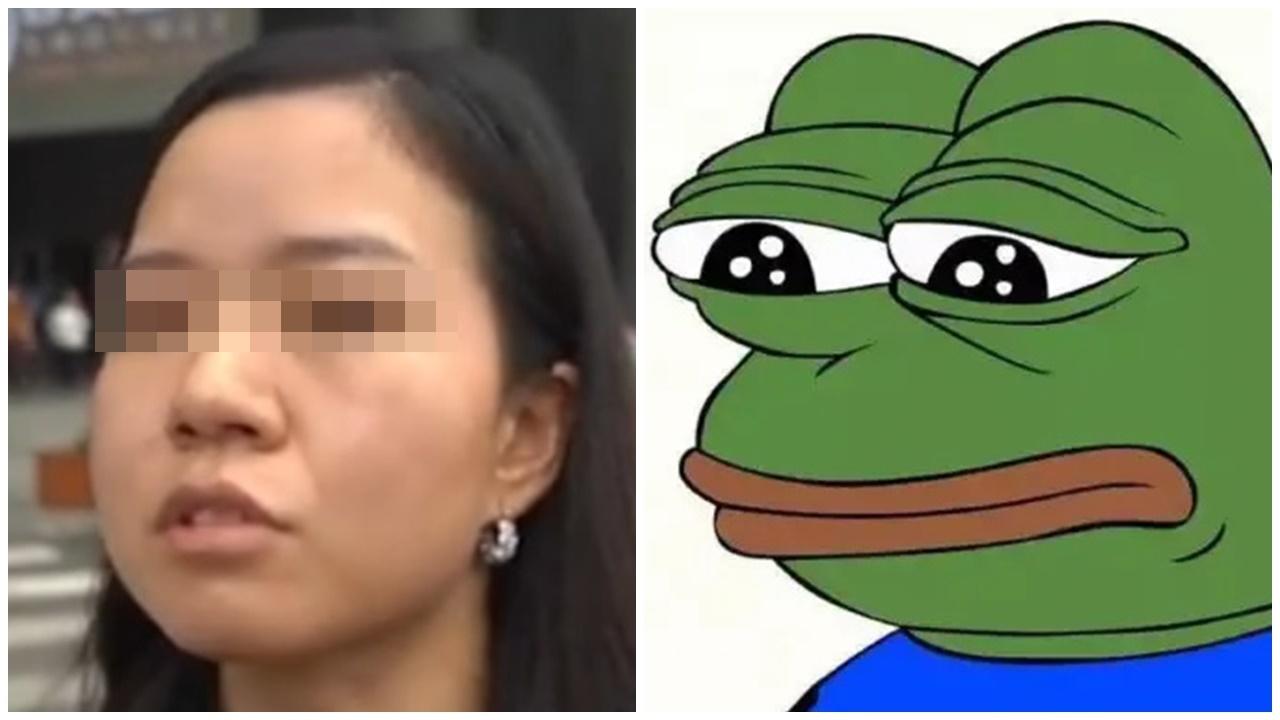 貴陽女割雙眼皮，寬度達12毫米驚變Pepe蛙。