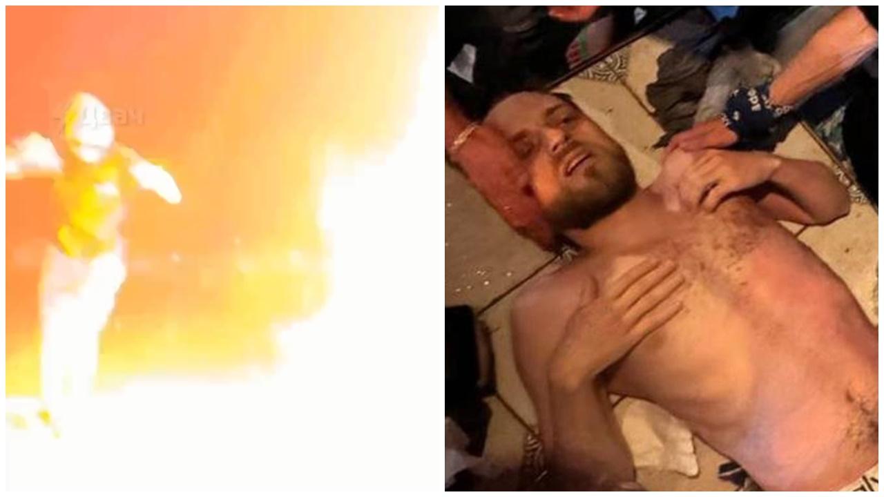 男遊客碼頭跳開心舞慘被雷劈，奇蹟甦醒：像在地獄燃燒。(X)