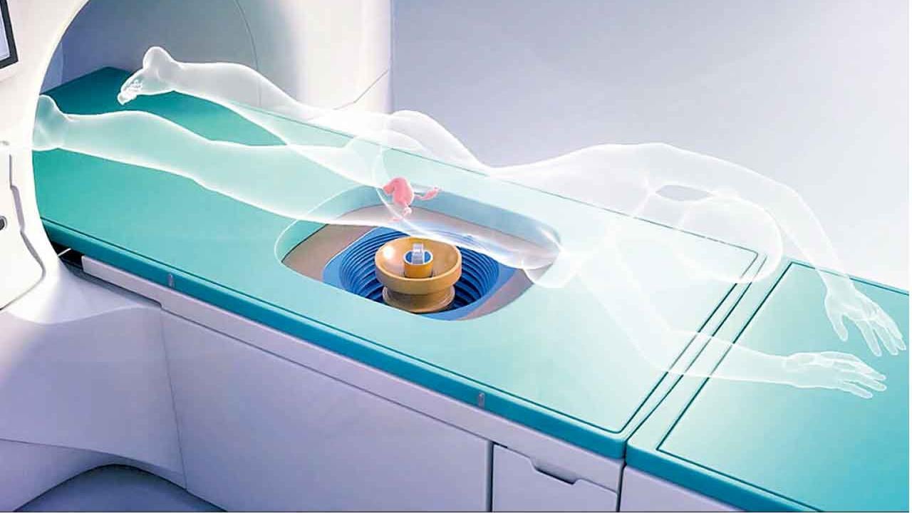 高強度聚焦超聲治療婦科疾病