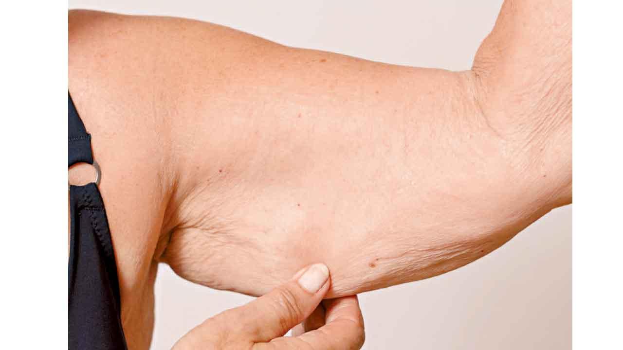 甚麼是肌少型肥胖？