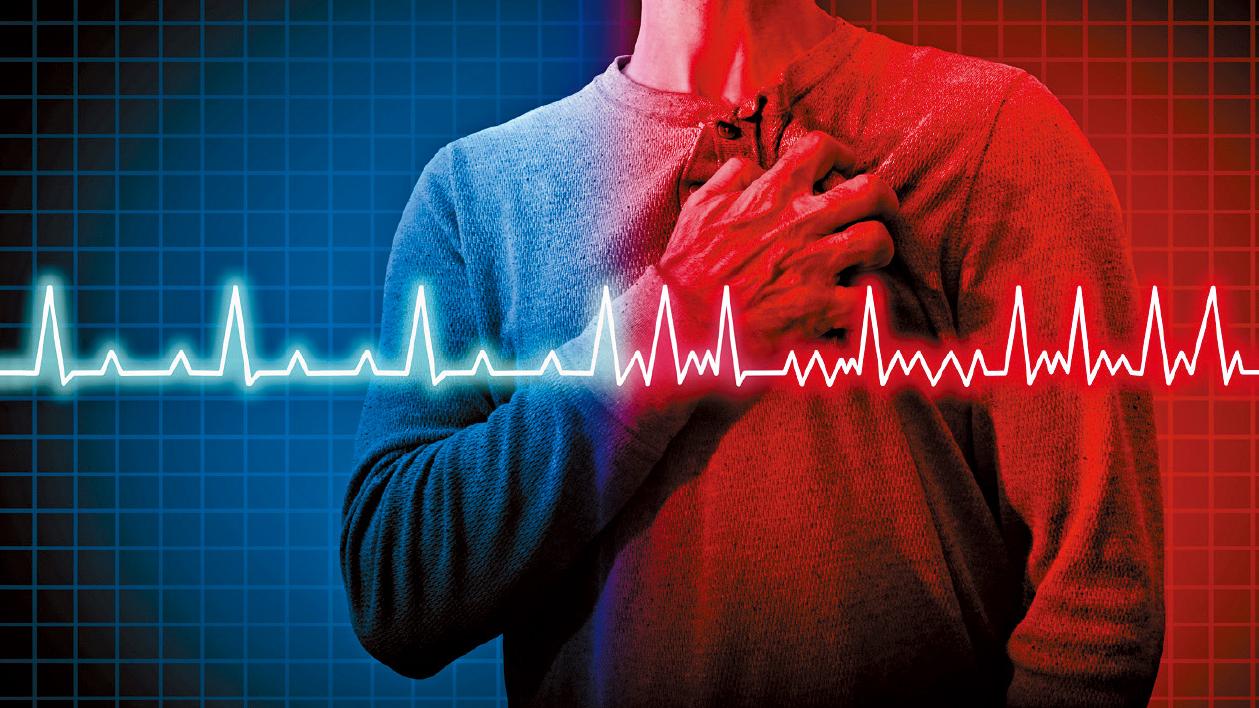 導管消融術+左心耳封堵術 一次過解決房顫