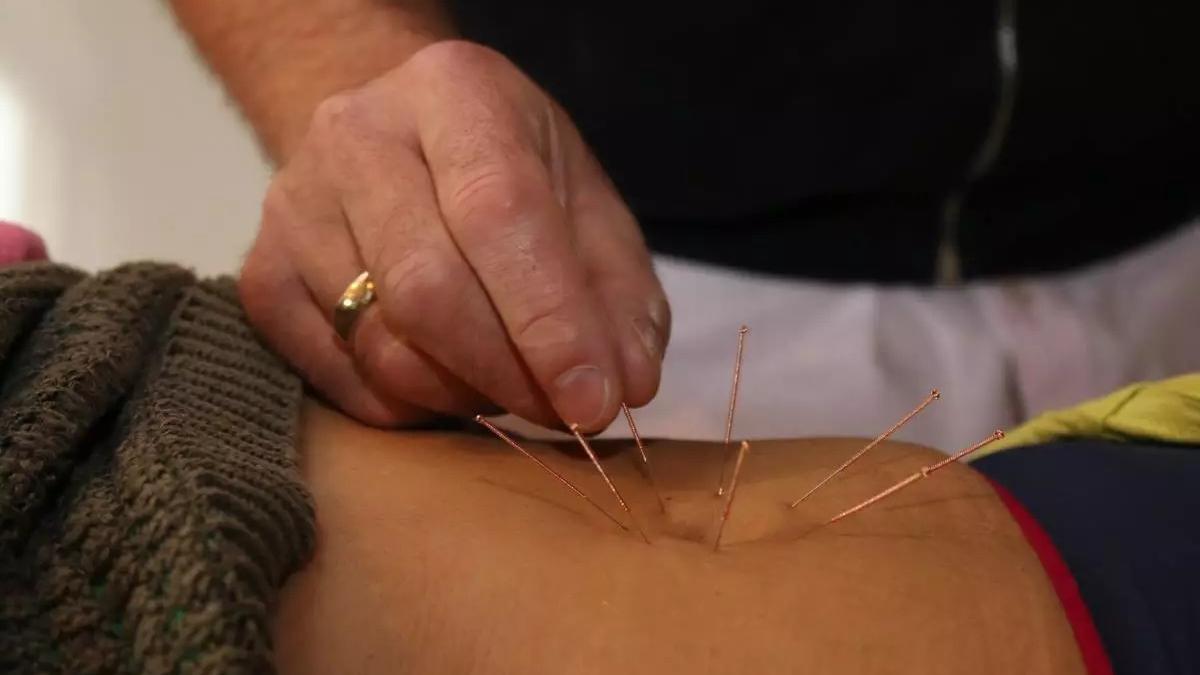 針灸