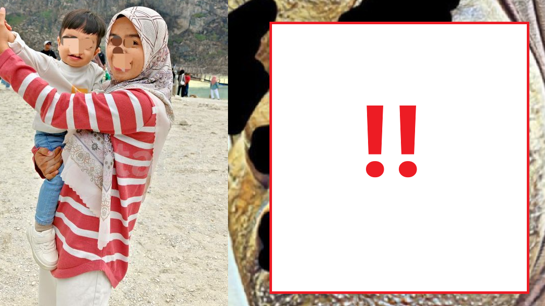 女子遊印尼疑撞鬼？面爛腿瘀床搖 團友聞到「異香」或是關鍵