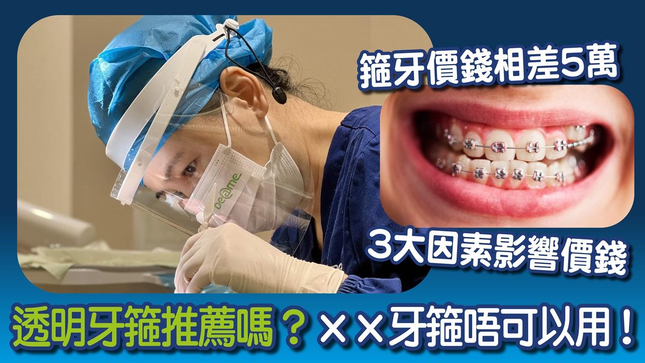 箍牙近年愈來愈普遍，主要受惠於箍牙價錢不斷下降。以往箍牙價錢可能要花費到十萬或以上，價錢不是一般家庭可以負擔。直至出現了透明牙箍及 3D 打印技術，直接改變了箍牙方式及種類，令製作有效矯正牙箍的成本大大降低，即睇文章留意 3 大影響箍牙價錢因素。