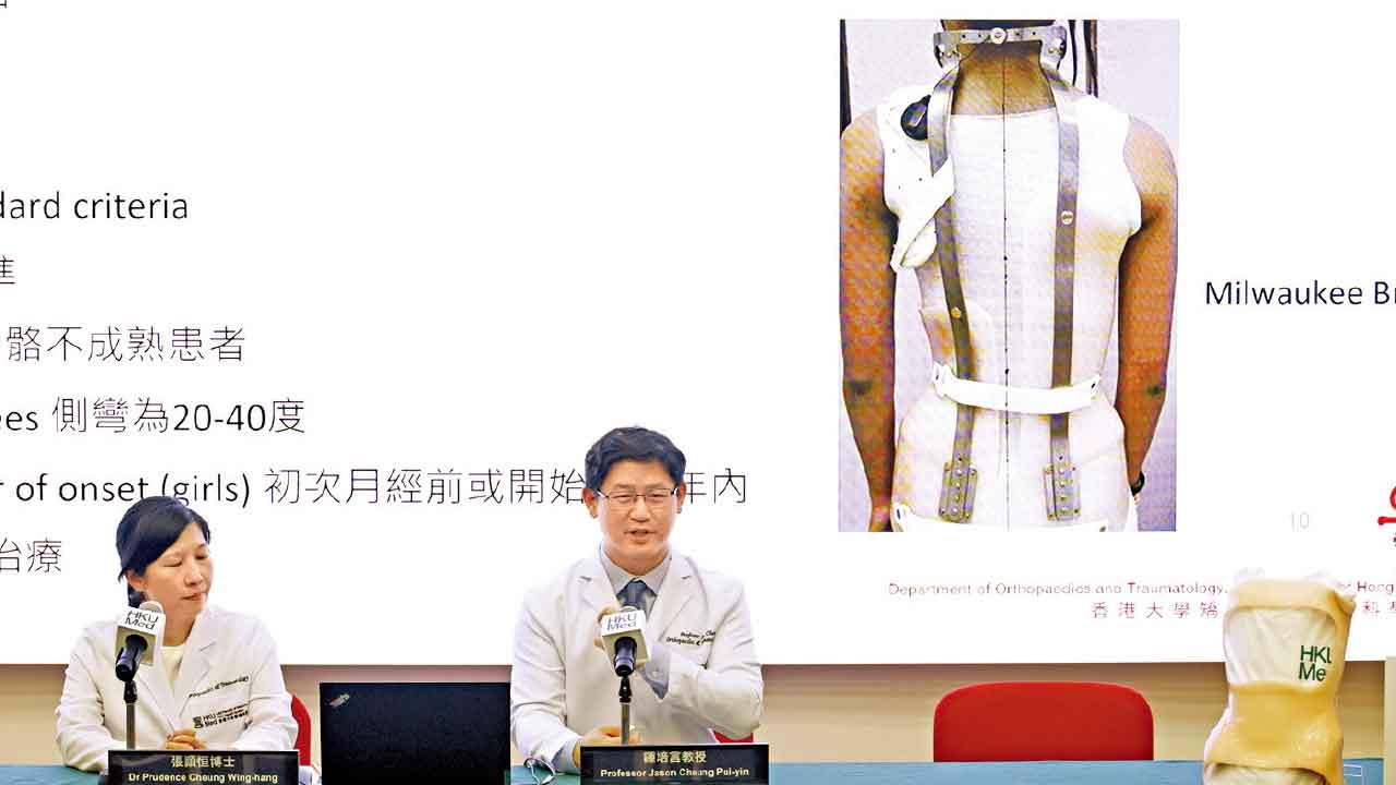 原發性脊柱側彎童 港大醫學院研究：骨骼成熟後可即停用矯正支架