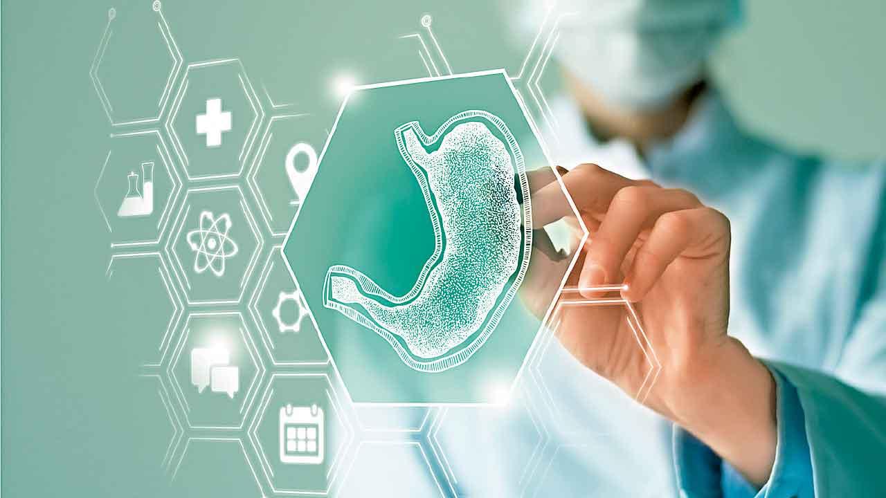 AI輔助上消化道內鏡 揪早期胃癌