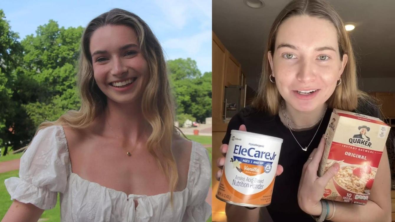 美女嚴重食物過敏連接吻都可能死　想吻她先要遵守3條規則