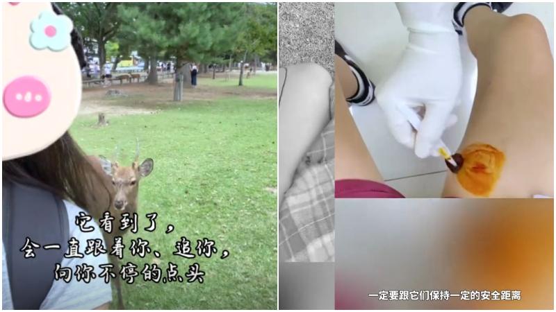 內地女遭奈良鹿傷腳要打針　大批網民指「不給鹿餅就頂你」