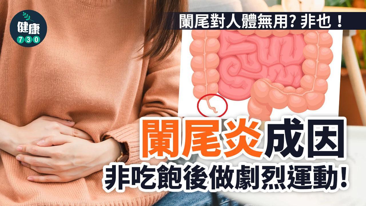 盲腸炎原因｜䦨尾炎症狀 施手術切咗就好？（am730製圖）
