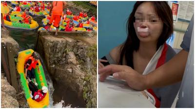 廣西女玩激流體驗撞石斷牙　慘變孖潤腸向景區索償