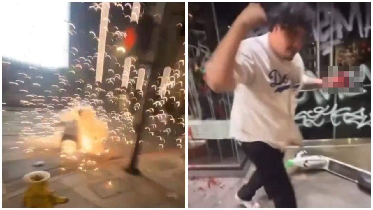 慶祝道奇封王樂極生悲，男子點煙火炸爛手掌。(X)