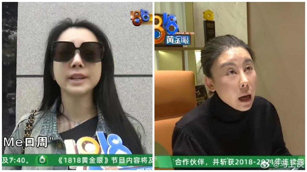 杭州女投訴花12萬整容被說老了10年，網民錯重點「主管都這樣還敢消費」。（微博）