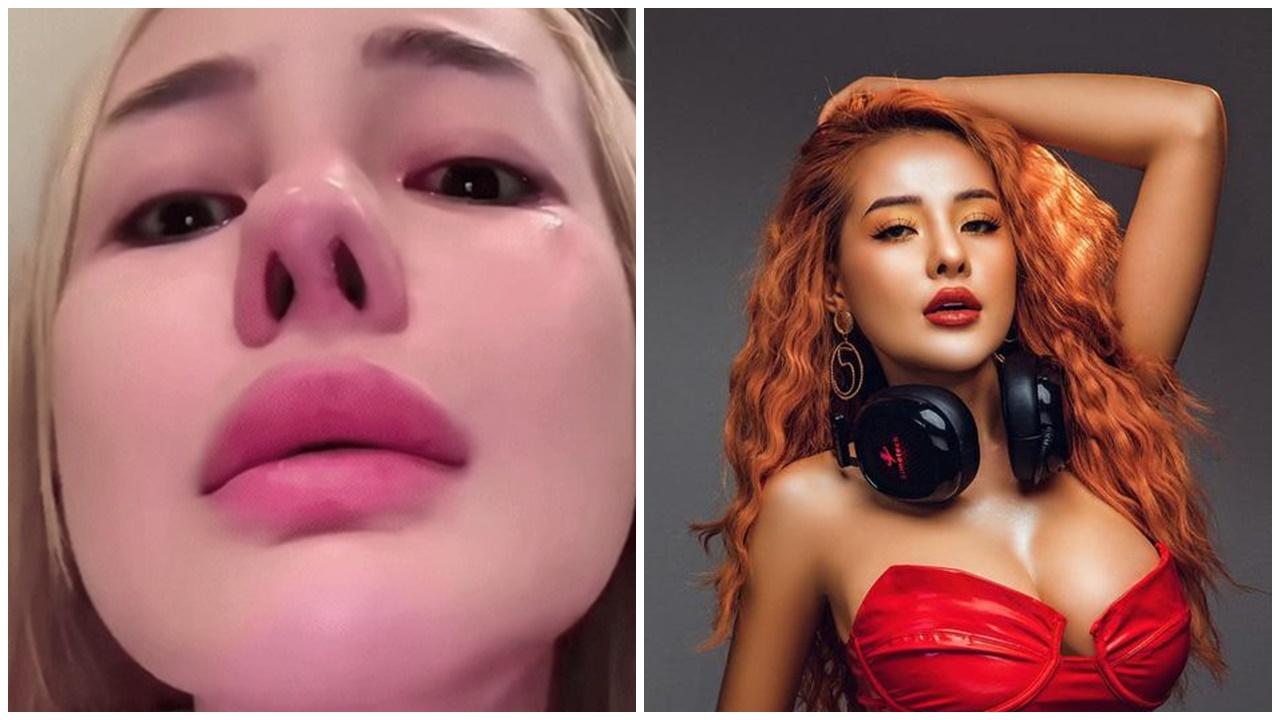 越南性感女DJ哭訴，在南韓整容整歪鼻。