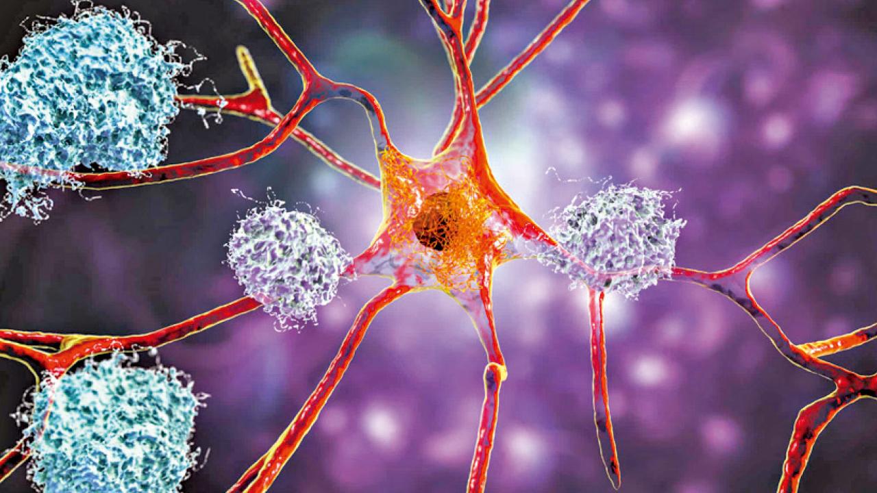 治療失智比醫好癌病更值錢