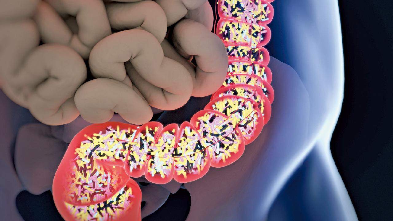 腸道細菌多 手術易感染