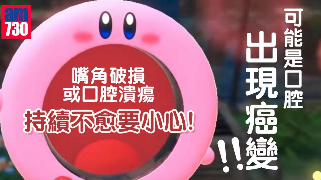 口腔癌｜嘴角不見好轉要留意 預防方法包括不吸煙（am730製圖）