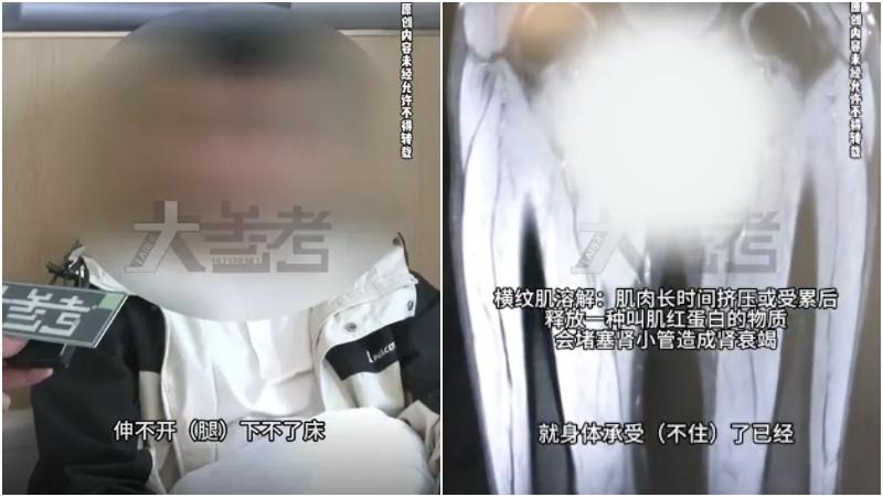 內地男回鄉幫爸媽採蒜苗　過勞致橫紋肌溶解屙黑尿