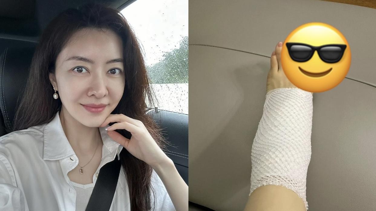 熊黛林苦呻一個月扭傷腳兩次 網民發現另一問題更嚴重建議做手術