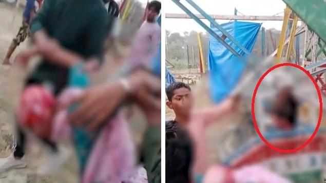 少女從摩天輪救下(左圖)，頭髮連頭皮還留在座位上(右圖，紅圈)。(互聯網)