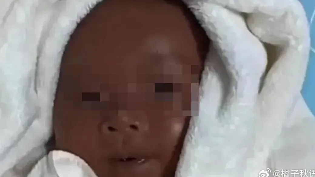 上海女誕黑皮膚嬰兒惹出軌疑雲　醫：或基因突變