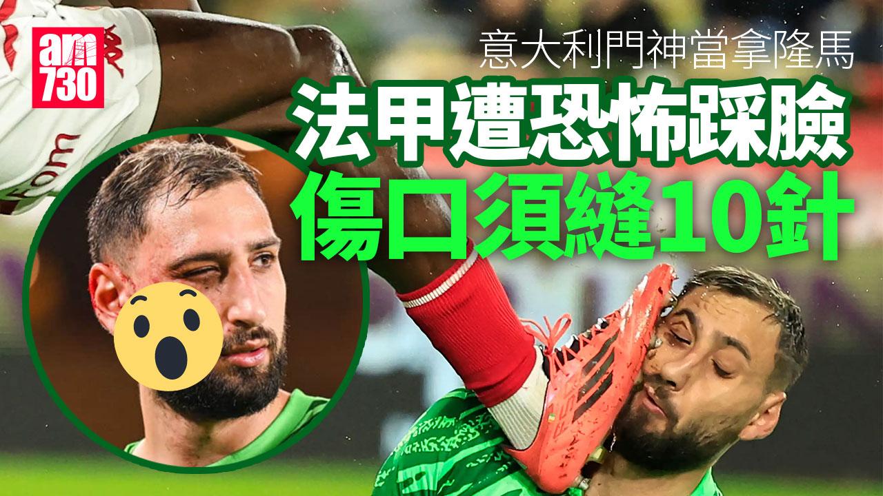 法甲｜巴黎聖日耳門破摩納哥　當拿隆馬慘遭踩傷臉