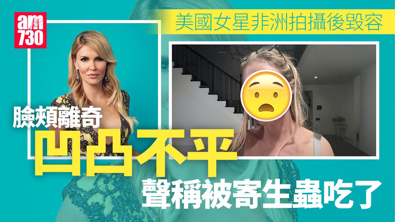 美國性感女星臉頰凹凸不平 稱「臉被寄生蟲吃了」