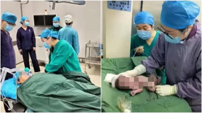 山東60歲高齡產婦剖腹生子　網民驚嘆「保養得好」