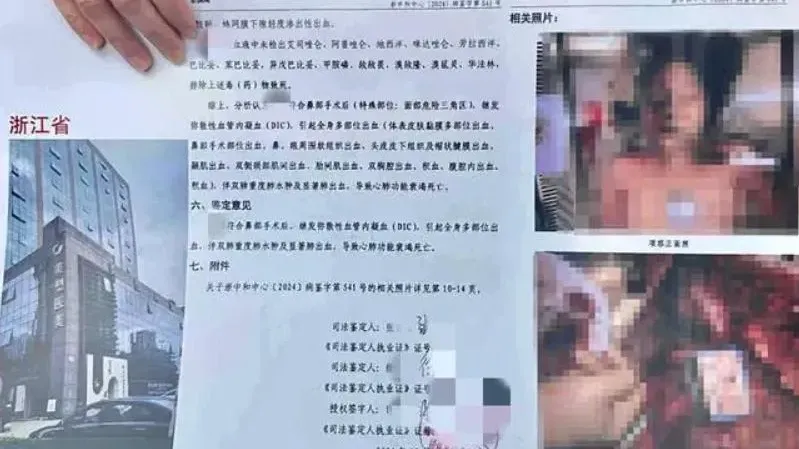 網友曝光的法醫檢驗報告。（圖/翻攝新浪微博）