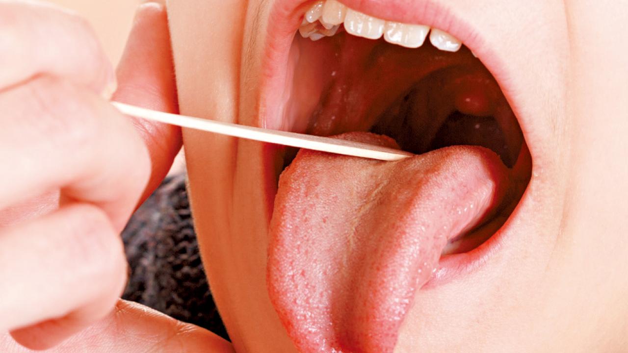 喉嚨上有白點就是細菌感染嗎？