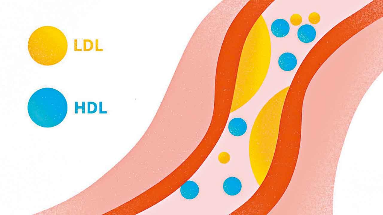 膽固醇之謎：好膽固醇唔一定好