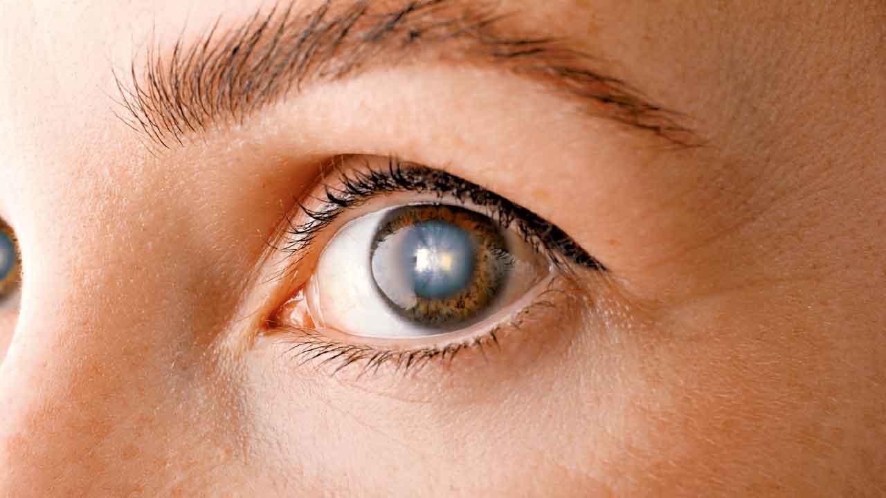 白內障 術後宜平躺勿捽眼