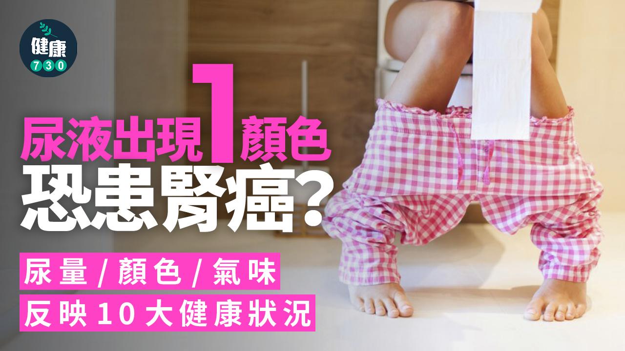 尿液 小便 腎癌 癌症 尿液顏色 小便異常