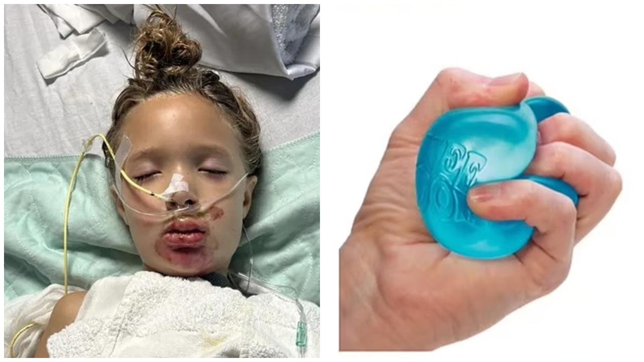 TikTok挑戰將玩具放微波爐加熱竟爆炸，7歲女童面胸燒傷。(X)