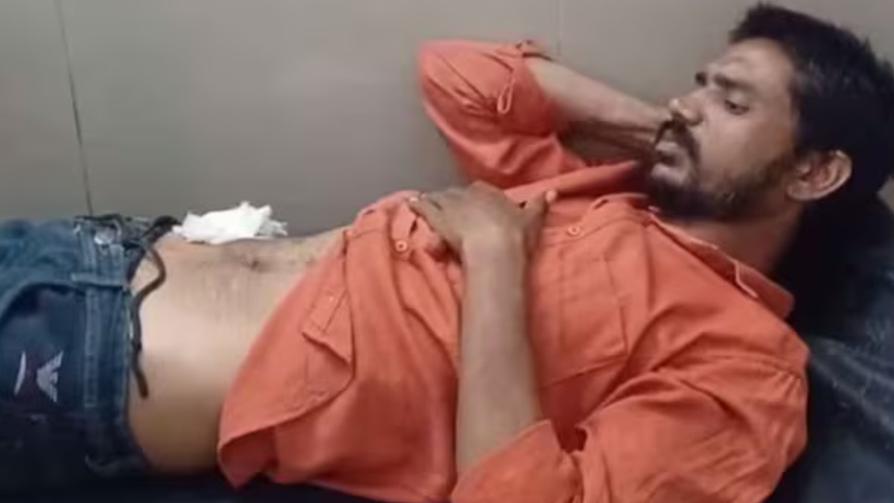 不堪腹痛折磨，男子睇YouTube自己劏肚流血不止。(X)