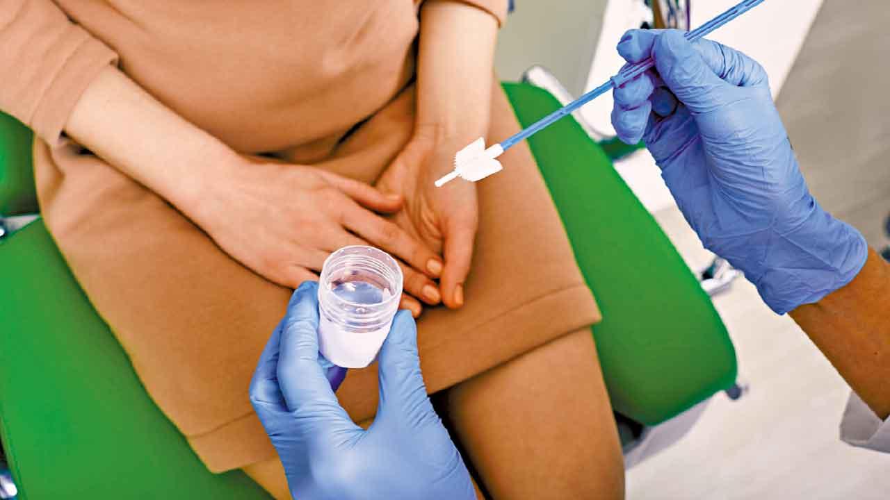 定期篩查 預防九成子宮頸癌