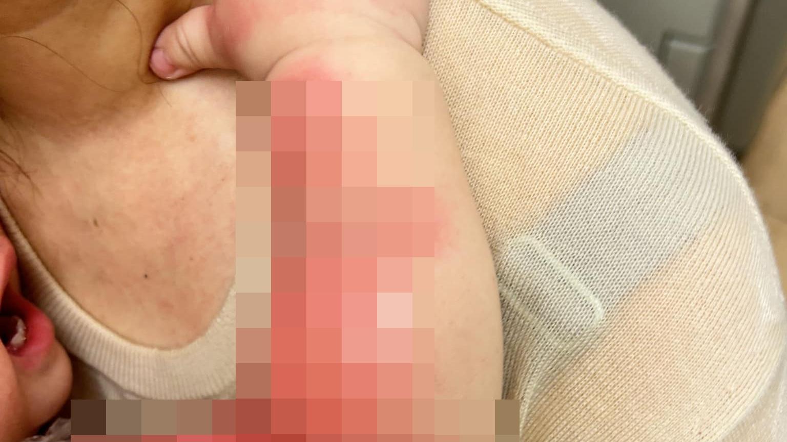 沙田1歲男嬰遭灼傷，父質疑菲傭受責備後報復。（fb「聘請工人姐姐關注組」圖片）