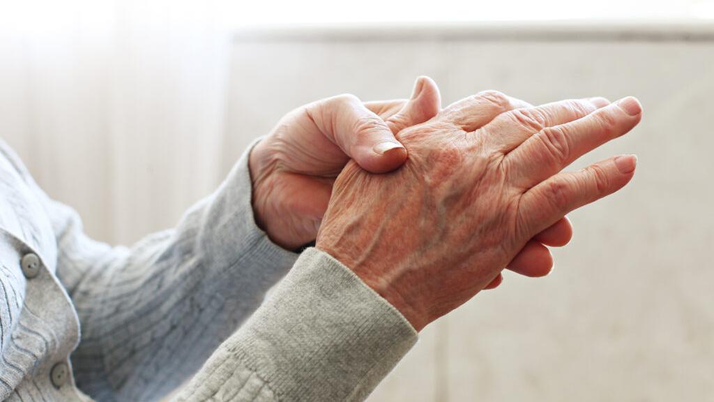 類風濕性關節炎