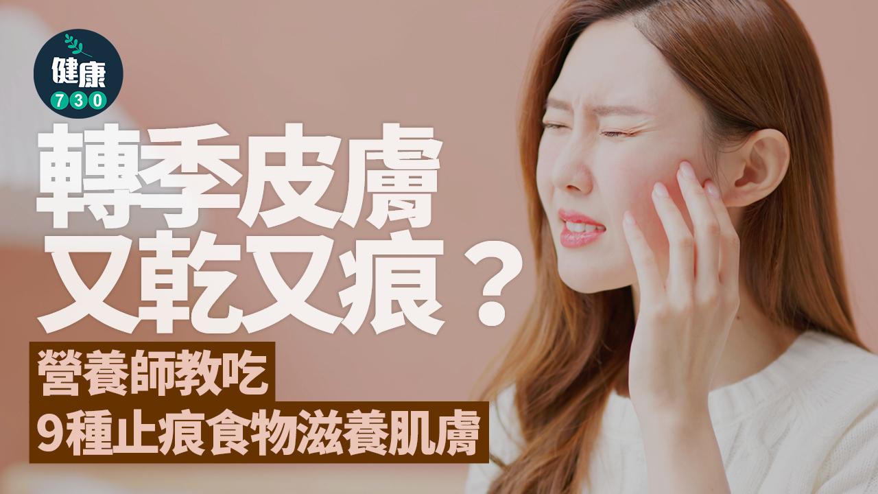 敏感 抗敏食物 皮膚健康 皮膚痕癢 維他命C 益生菌 槲皮素 健康飲食 過敏 過敏反應 換季皮膚