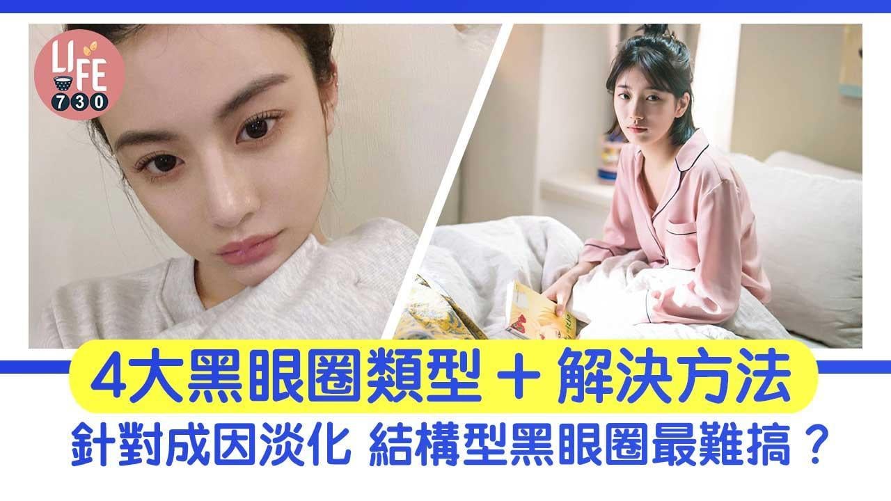 黑眼圈消除方法｜天然有效淡化4大類 結構型最難搞？（am730製圖）