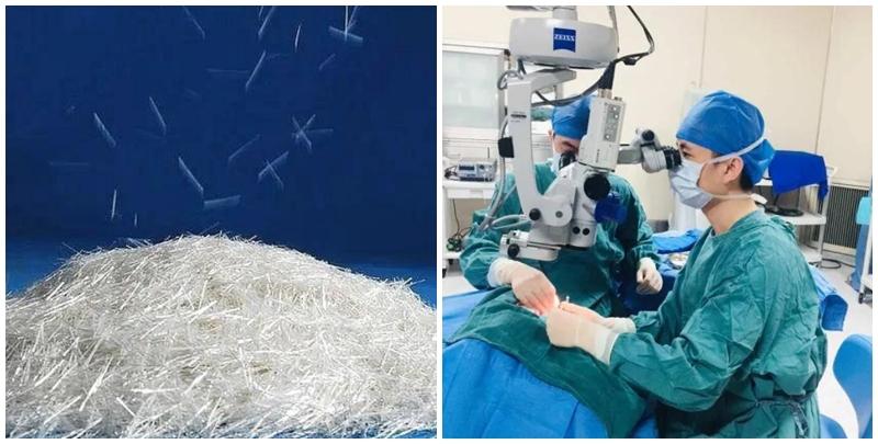 顯微鏡下，張醫生看到夏先生的眼睛裡有多處劃傷，右眼角結膜及眼瞼密布著幾十根比針頭更細的透明異物，好似中了現實版《斗羅大陸》裏的唐門暗器「暴雨梨花針」。（寧波晚報）