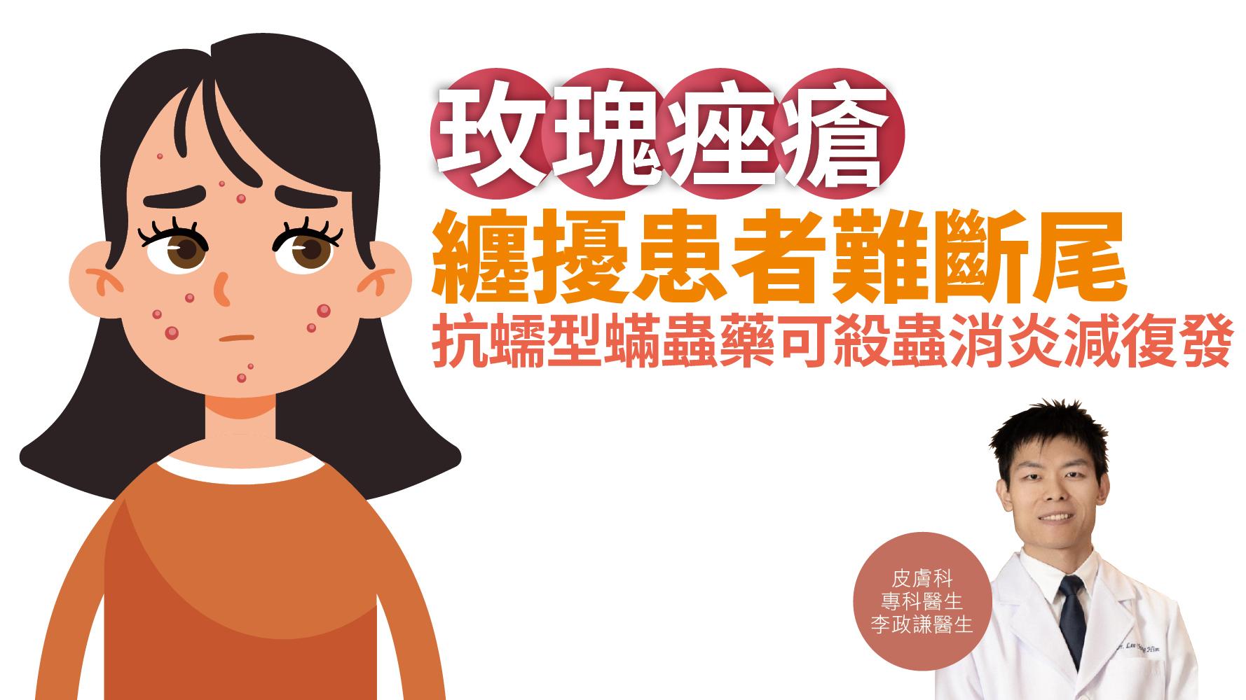 健康解碼｜玫瑰痤瘡 纏擾患者難斷尾 抗蠕型蟎蟲藥可殺蟲消炎減復發