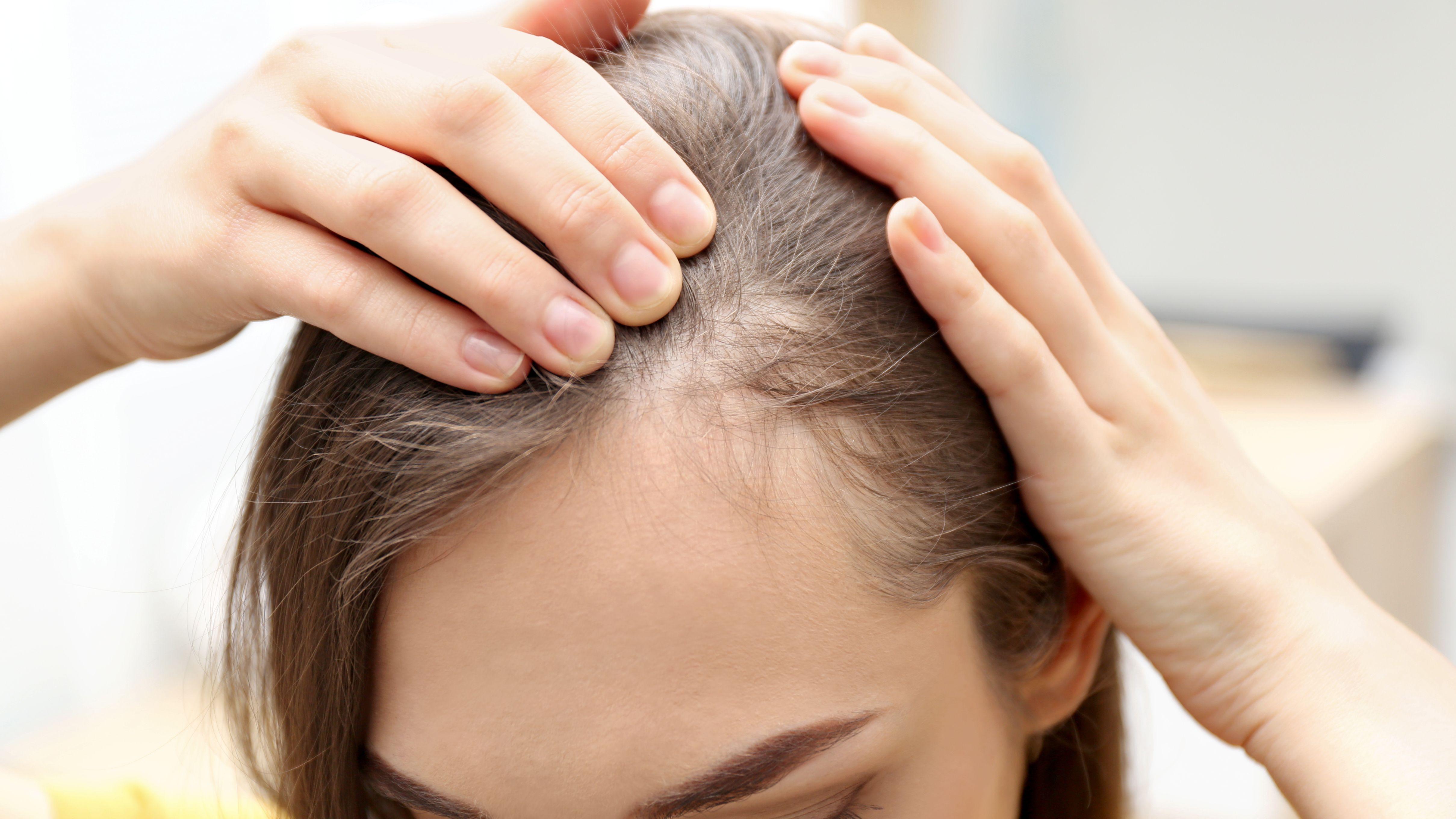 減肥 碳水 澱粉 肌肉流失 脫髮 停經 控制體重