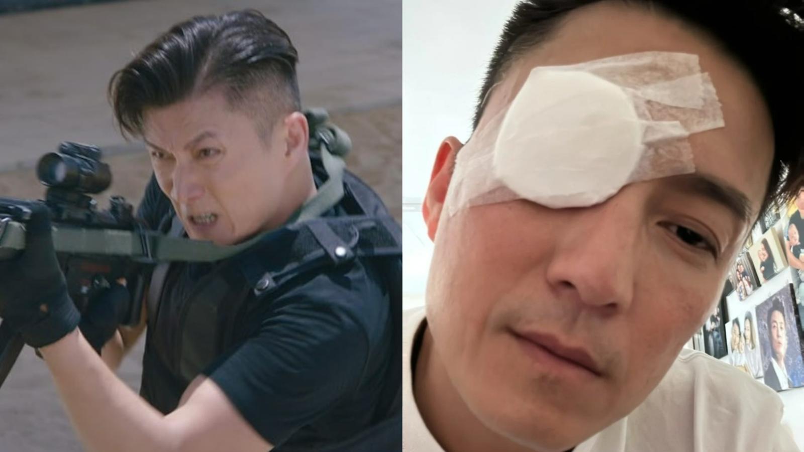 陳山聰自爆突發做手術 眼貼紗布親解康復進度